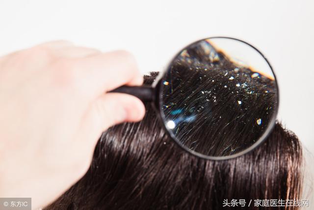 頭皮屑是怎么產(chǎn)生的