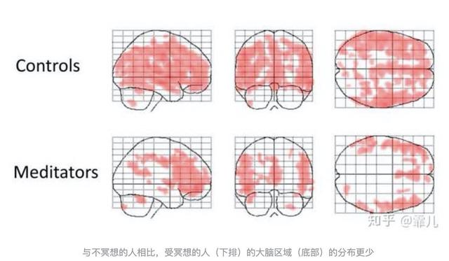冥想是什么意思