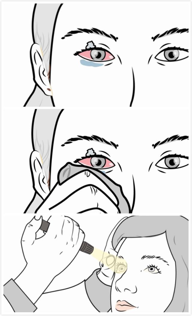 強(qiáng)力膠怎么去除
