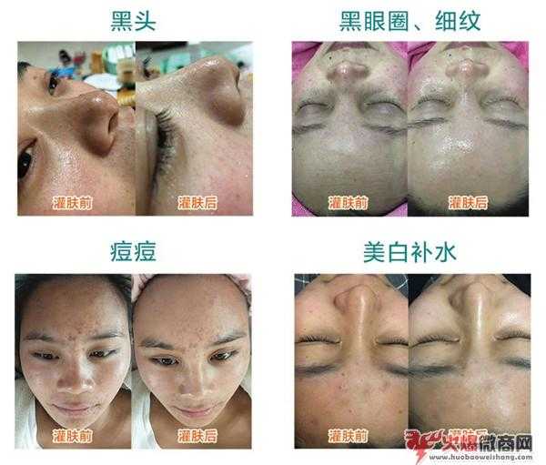 流暢度灌膚火爆微商界，微商新產品流暢度De.Mary怎么樣