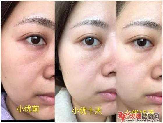 手把手教你從微商小白逆襲